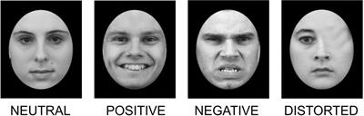 Neurophysiological Markers of Emotion Processing in Burnout Syndrome